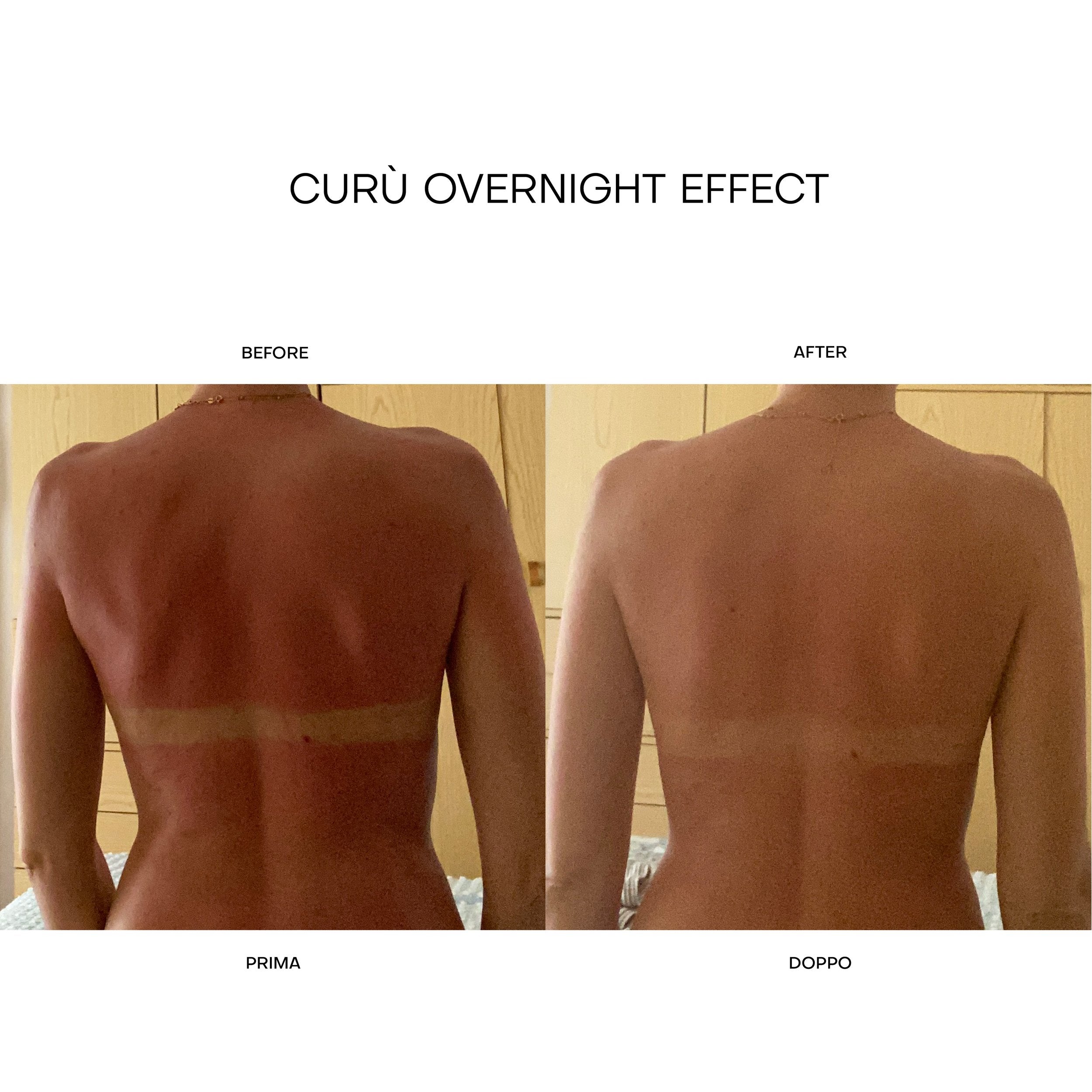 After Sun Facial Oil
